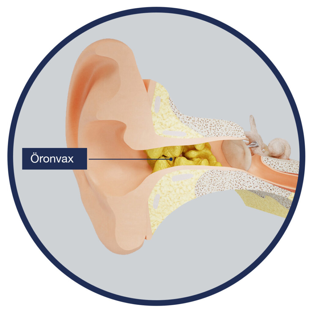 ta bort öronvax